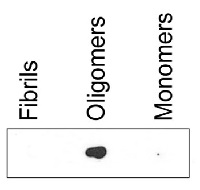 ASyO5 | Mouse anti-human alpha-synuclein | oligomer-specific (clone number 2,4) in the group Antibodies Human Cell Biology / Neuroscience / Neurodegenerative diseases / Parkinson's disease at Agrisera AB (Antibodies for research) (AS13 2718)